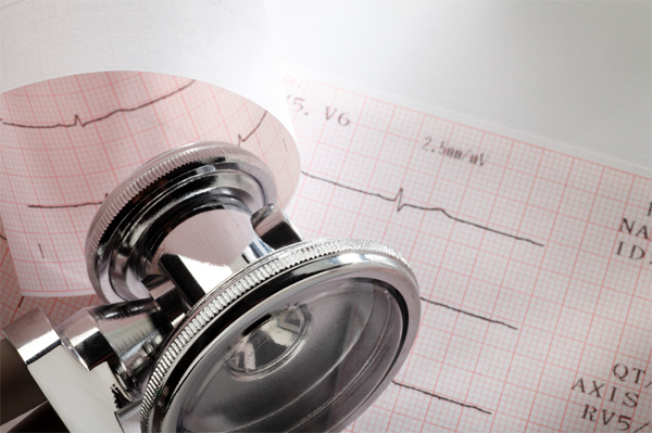 20210826_173452_0003 EKG Services